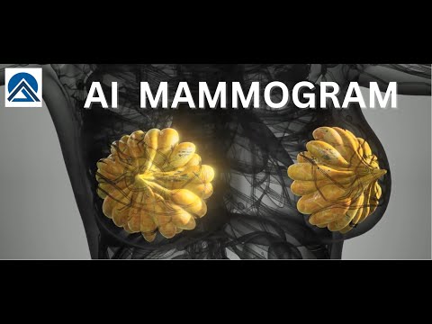 Revolutionizing Breast Cancer Detection: The Artificial Intelligence Mammogram Breakthrough #ai #agi